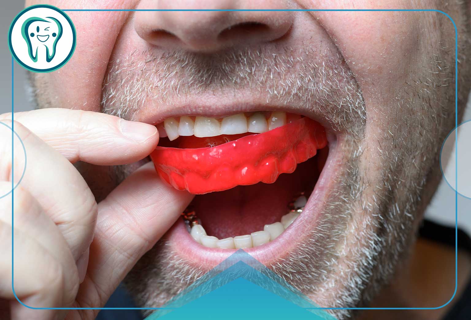 دندان قروچه چگونه درمان می‌شود؟