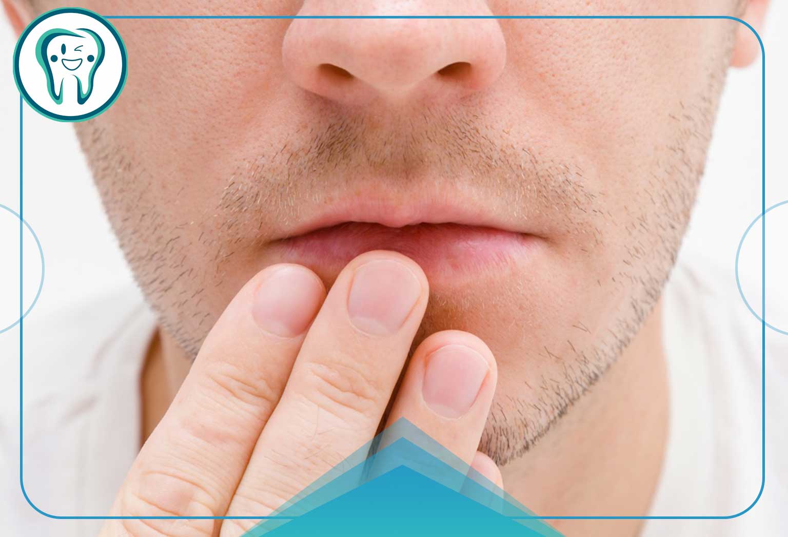 درمان خشکی دهان چگونه است؟