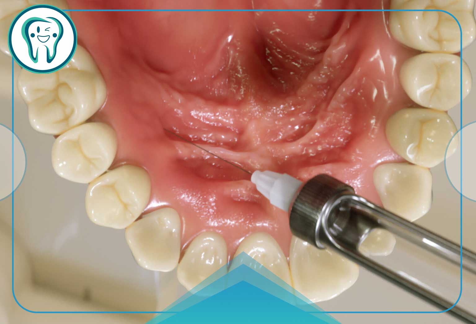 مزایای جراحی دندان چیست؟