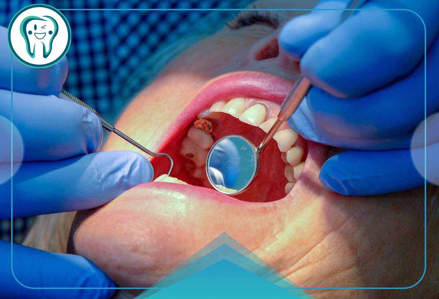 10 کاری که همیشه باید قبل از جراحی دندان انجام دهید