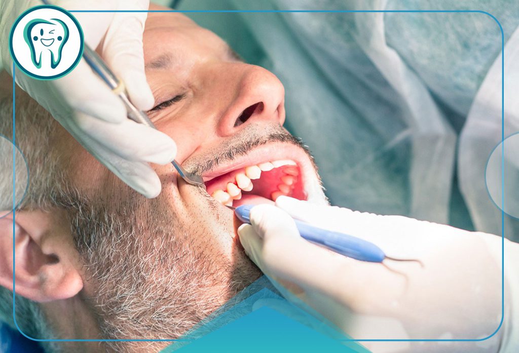 عصب کشی تخصصی دندان