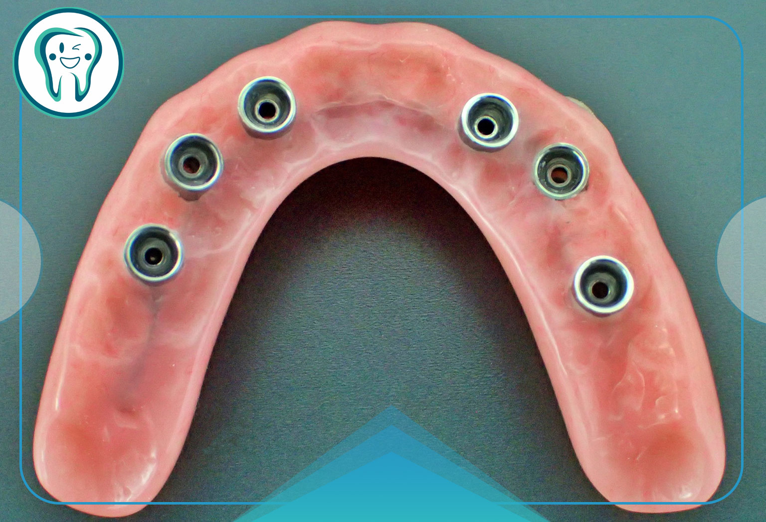 فرایند پروتز ثابت دندان چگونه است؟