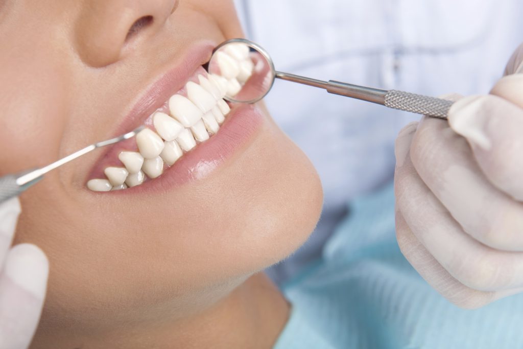 زیبایی دندان ها در دندانپزشکی