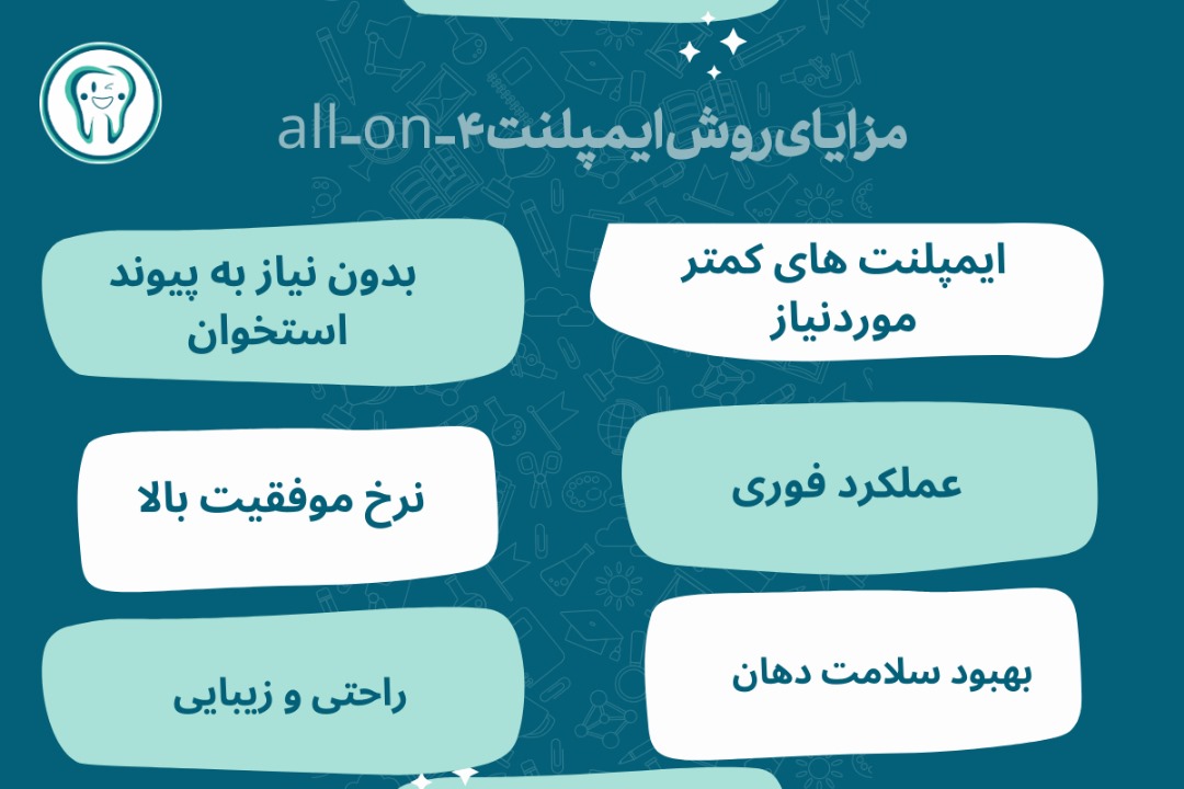 مزایای روش ایمپلنت all-on-4