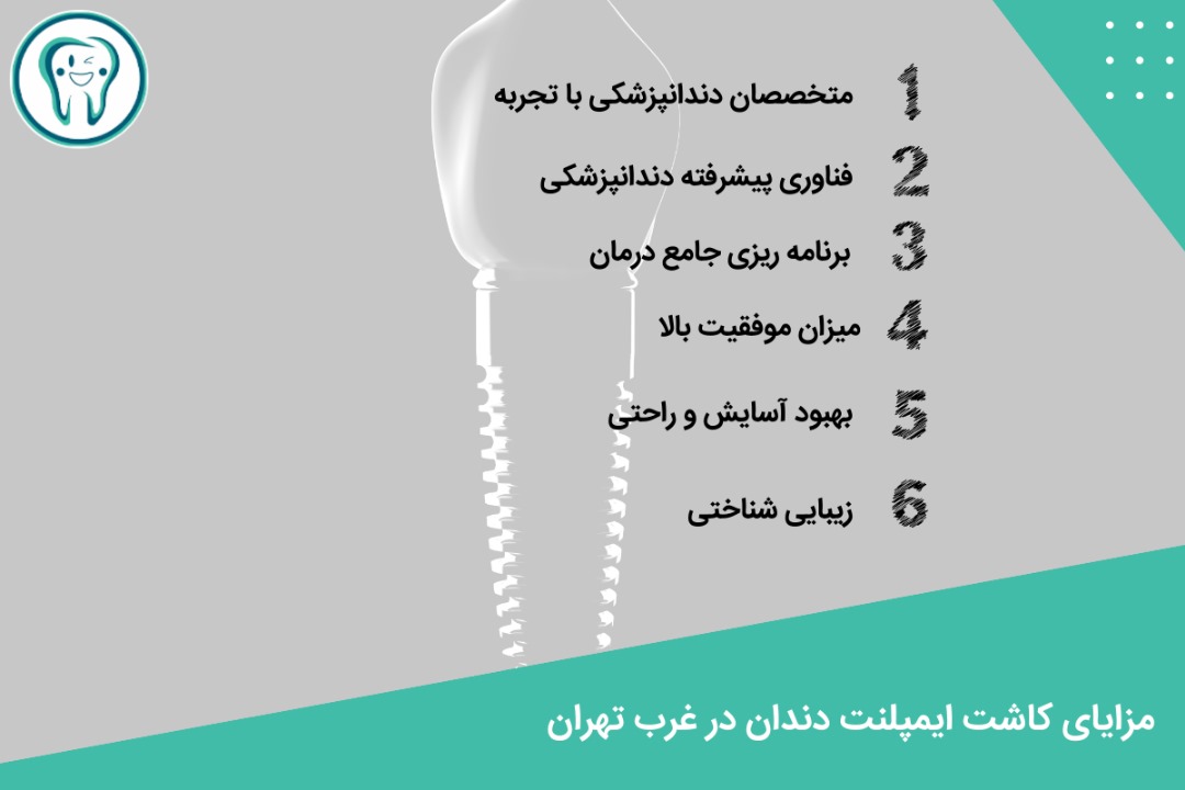 مزایای کاشت ایمپلنت دندان در غرب تهران