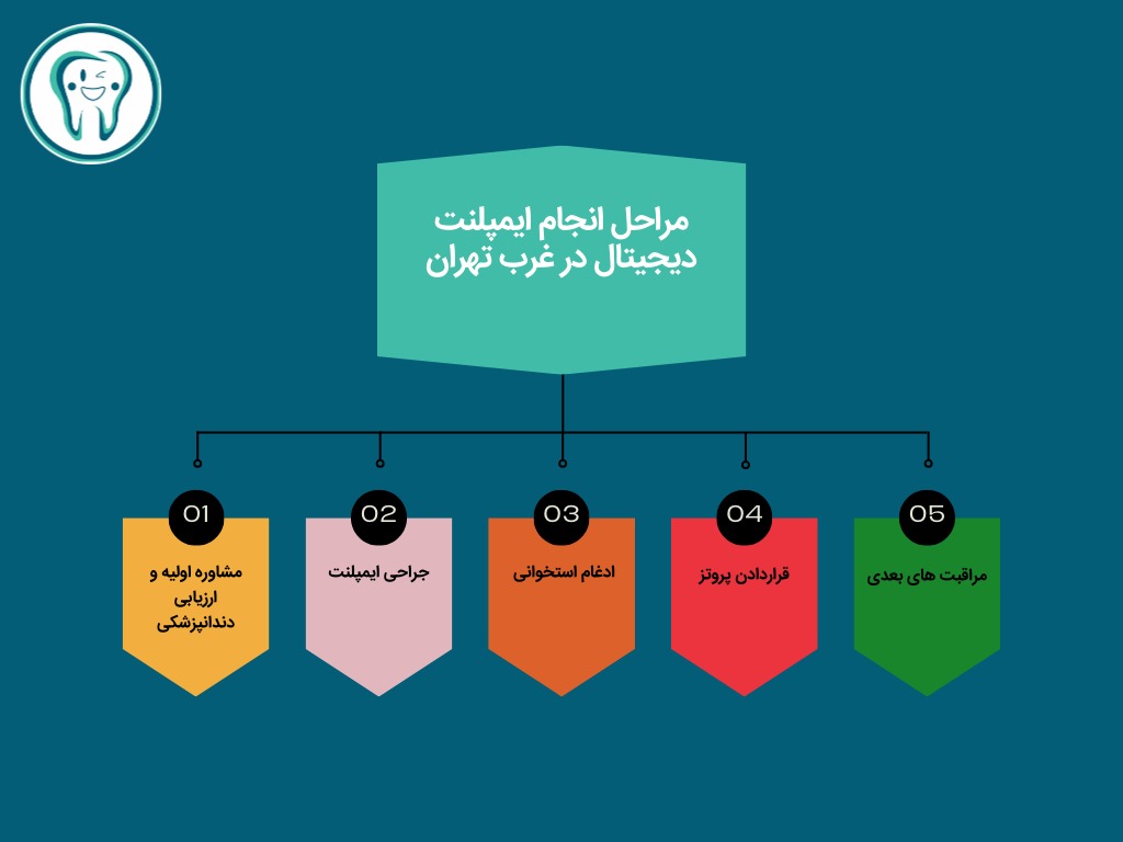 مراحل انجام ایمپلنت دیجیتال در غرب تهران