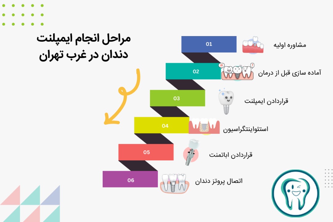 مراحل انجام ایمپلنت دندان در غرب تهران