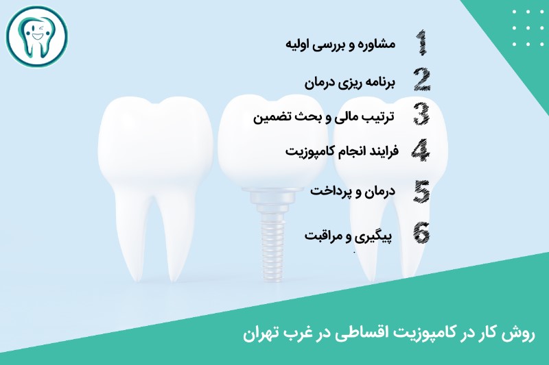 روش کار در کامپوزیت دندان اقساطی در غرب تهران