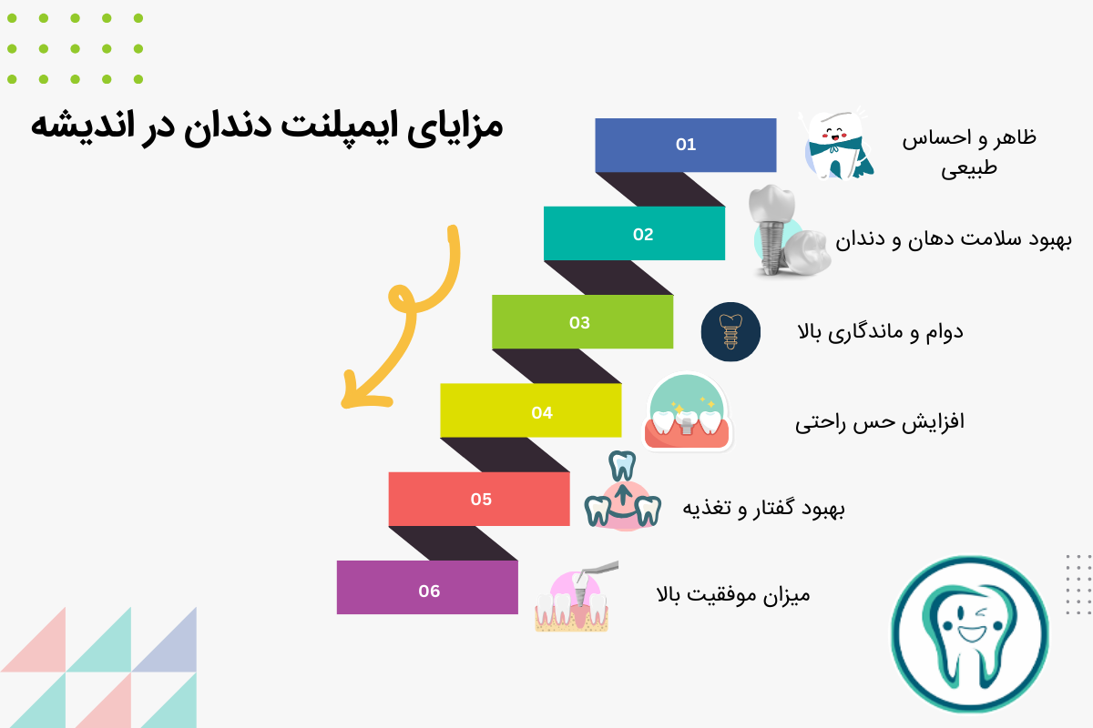 مزایای ایمپلنت دندان در اندیشه