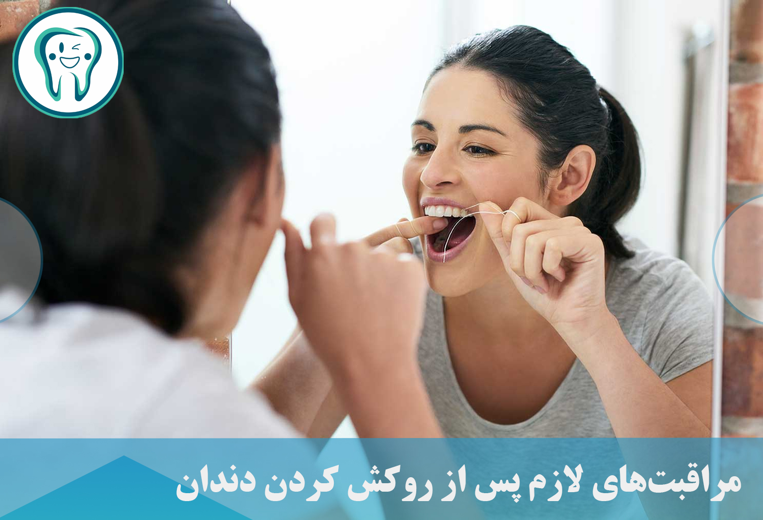 مراقبت‌های لازم پس از روکش کردن دندان