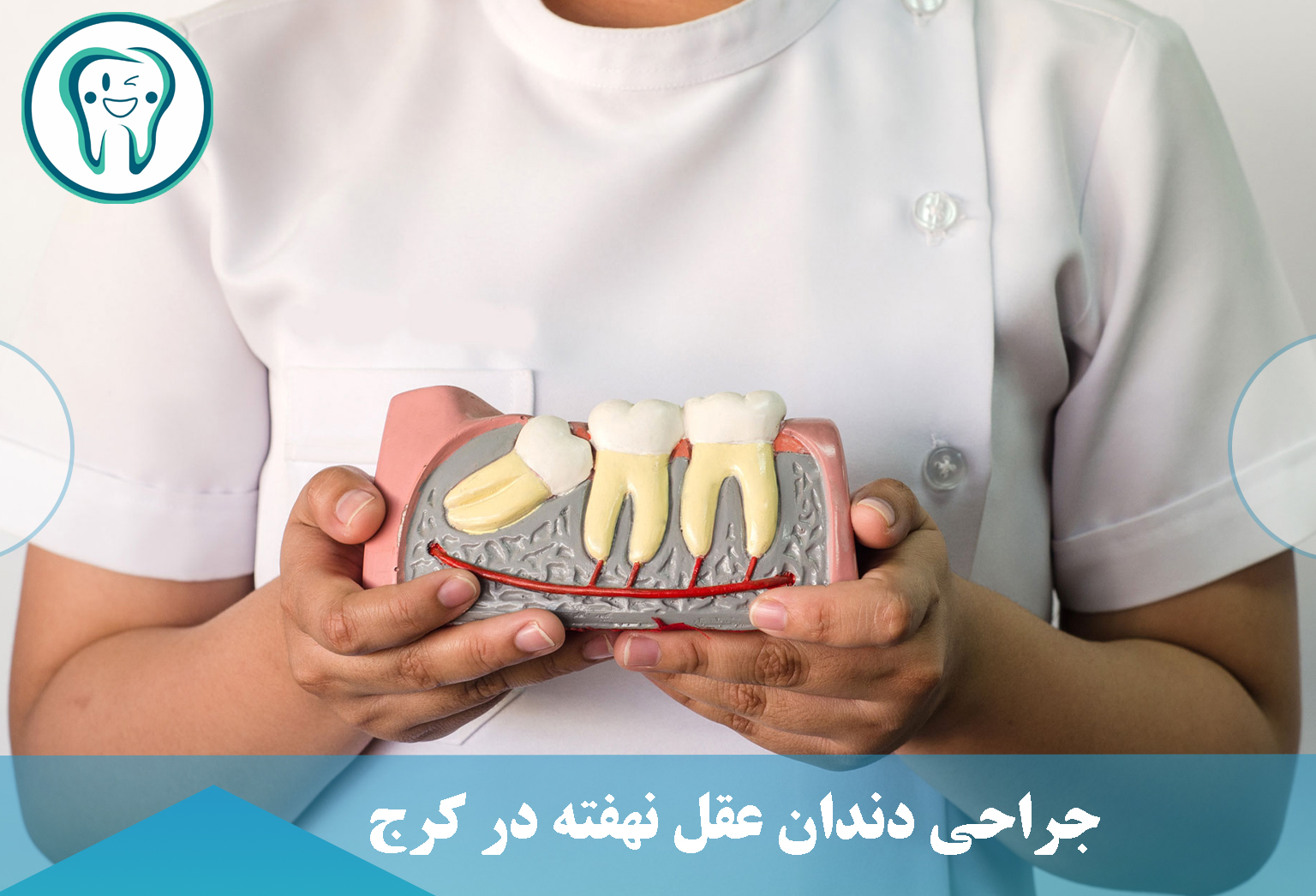 جراحی دندان عقل نهفته در کرج
