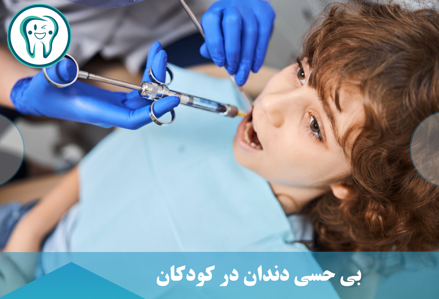 بی حسی دندان در کودکان