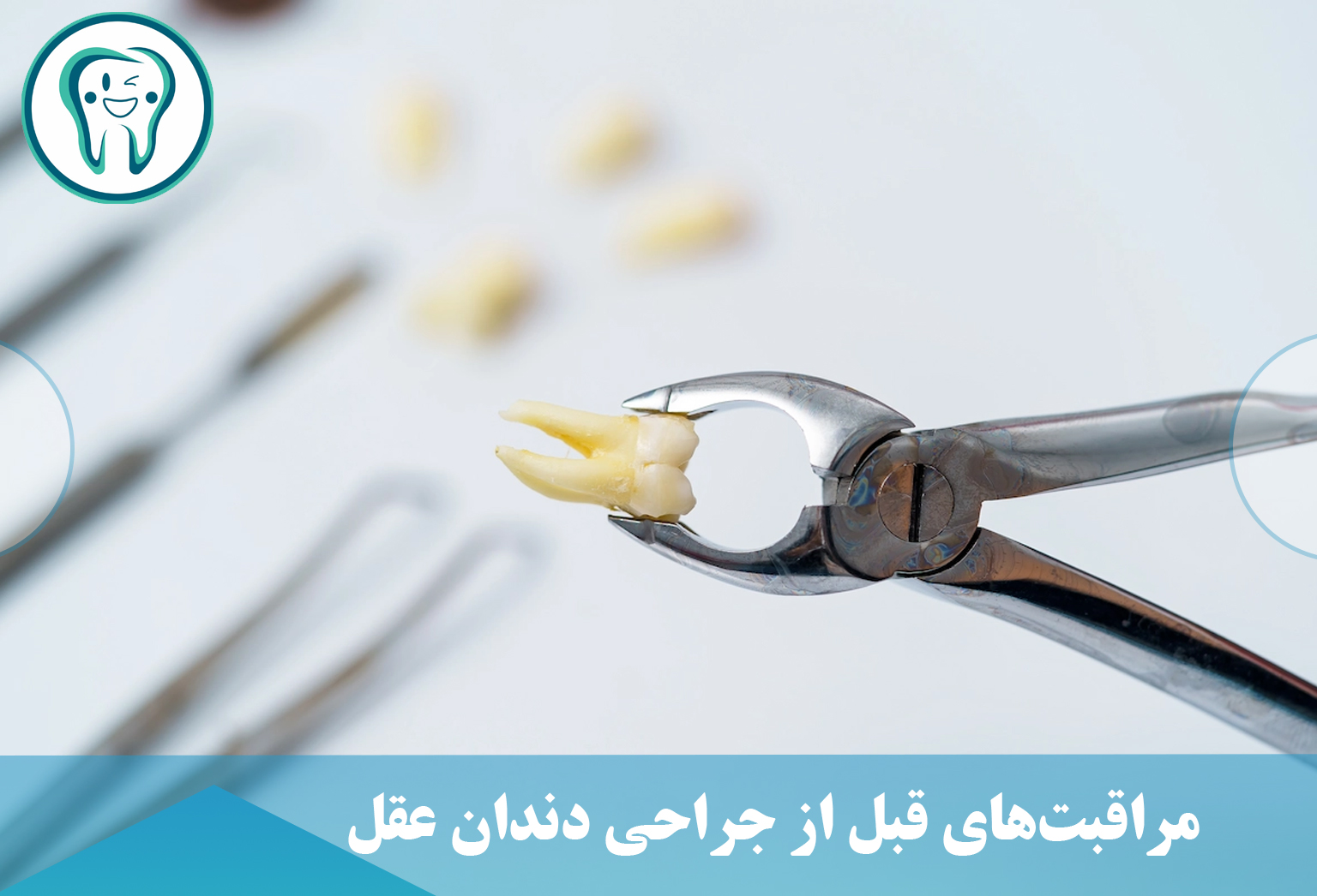 مراقبت‌های قبل از جراحی دندان عقل 