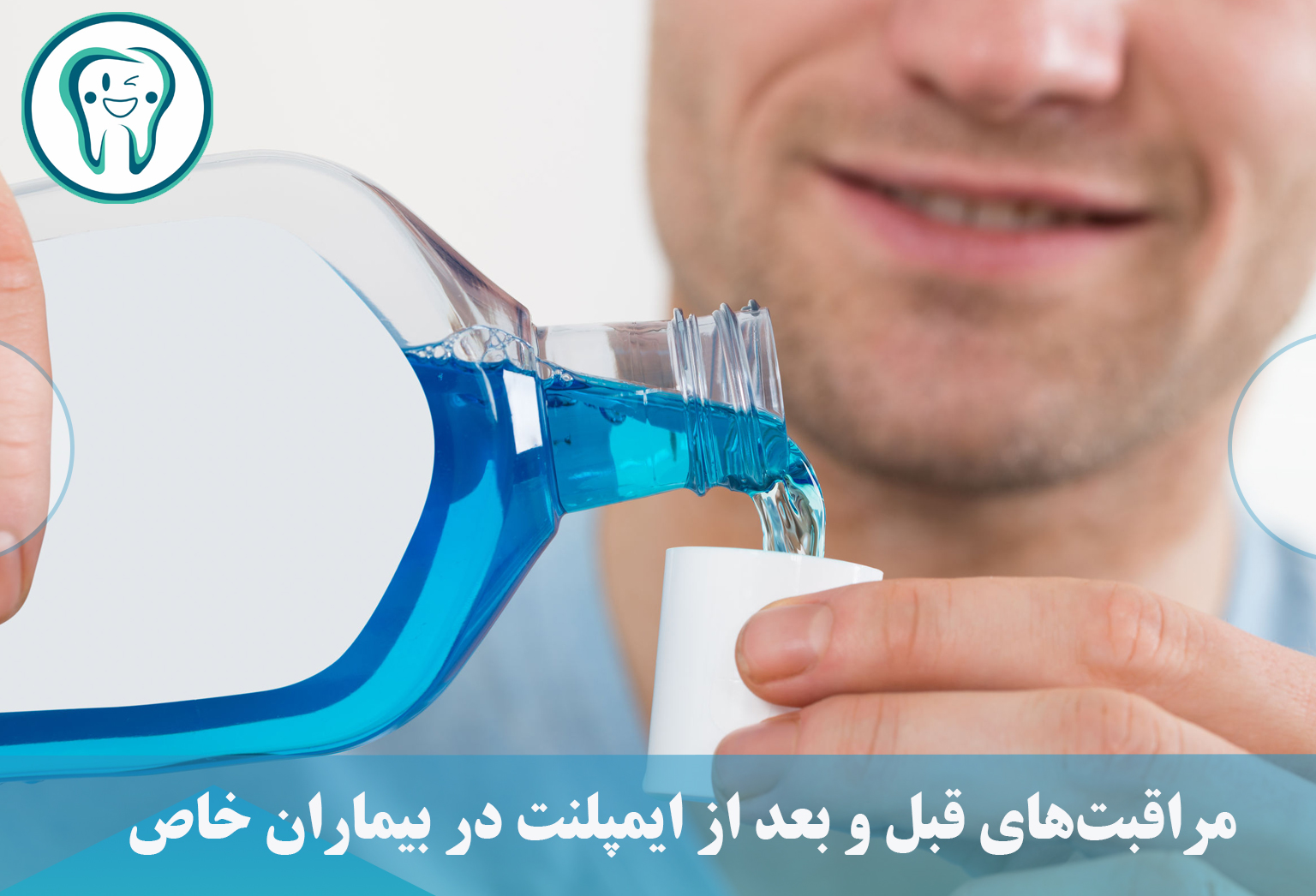 مراقبت‌های قبل و بعد از ایمپلنت در بیماران خاص