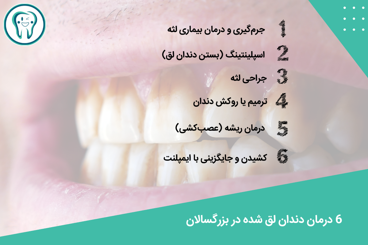 6 درمان دندان لق شده در بزرگسالان