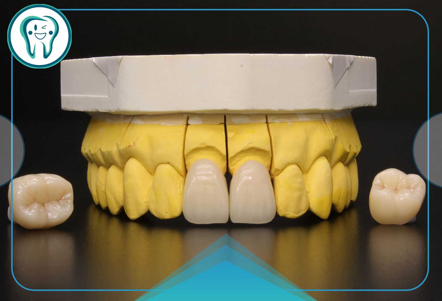 ترکیبات و ساختار کامپوزیت IPS