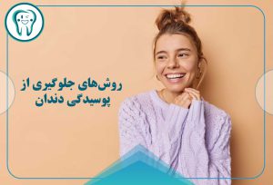 جلوگیری از پوسیدگی دندان