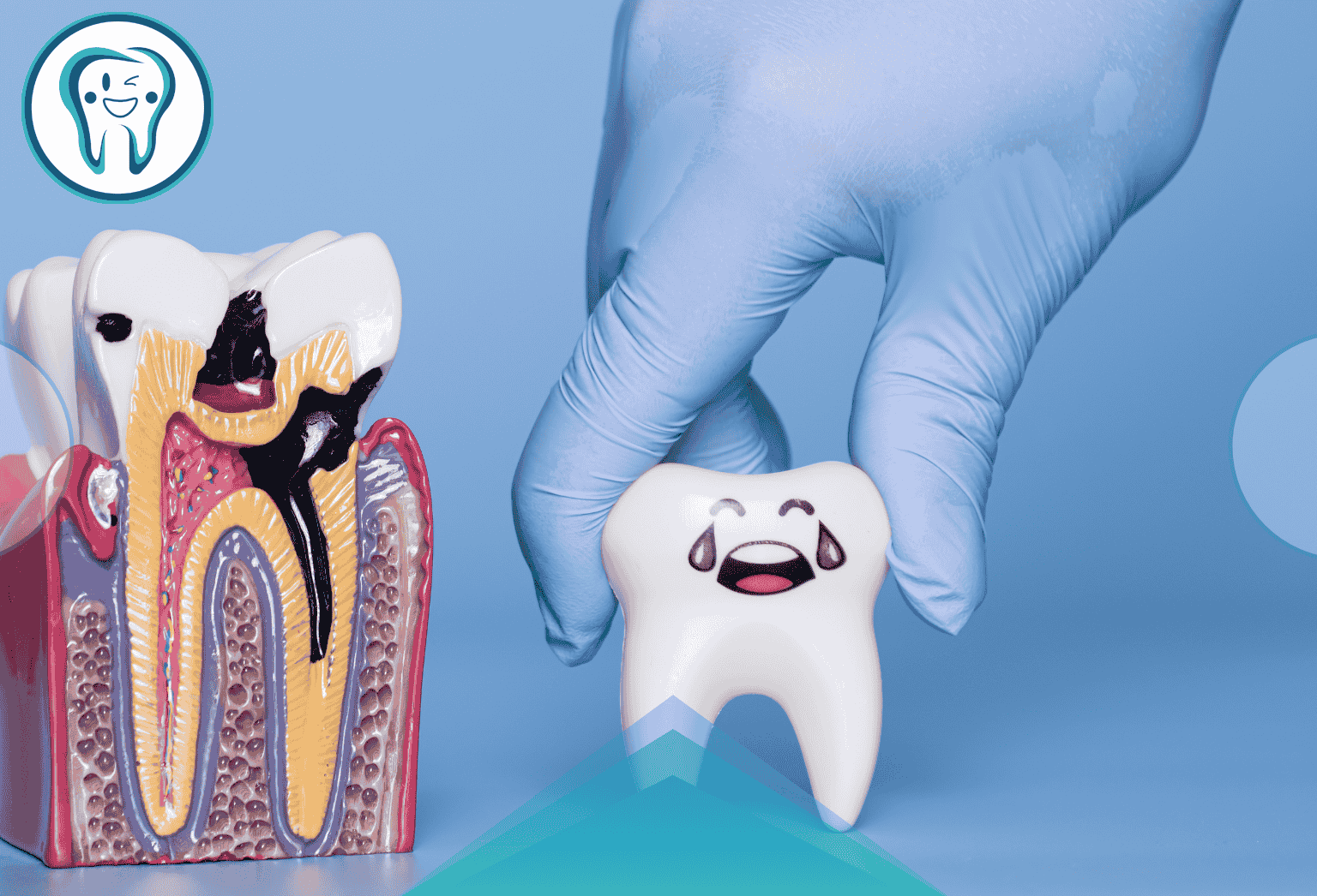 خارج کردن پالپ آلوده و ضدعفونی کانال‌ها: