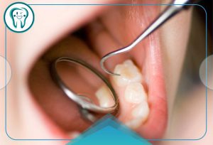 عمر دندان پر شده