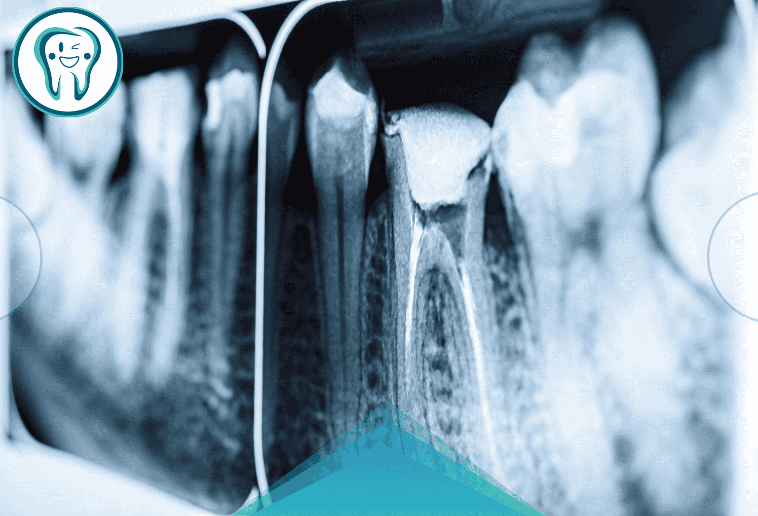 معاینه و عکس‌برداری رادیوگرافی