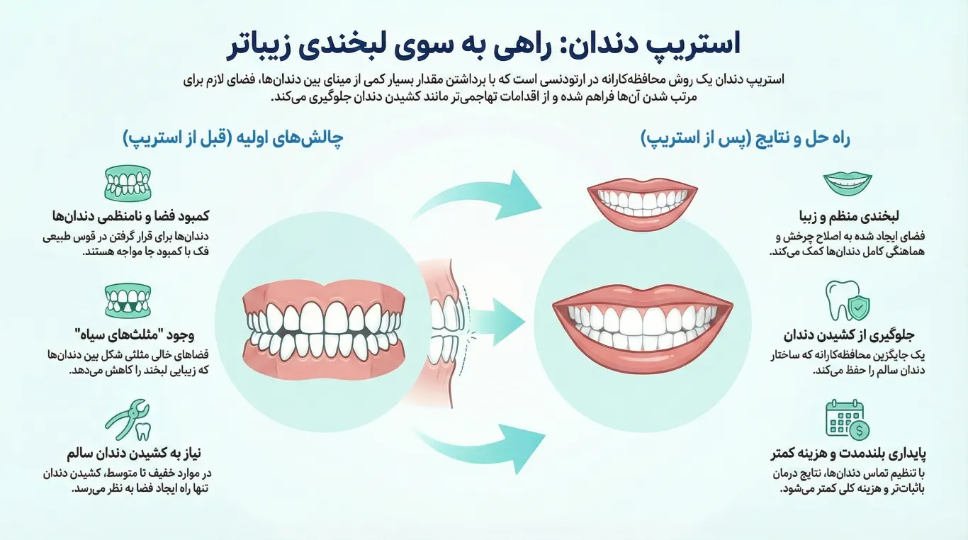 استریپ دندان؛ تجربهای سریع و بدون درد برای سفیدی دندان 4 مزایای استریپ کردن دندان