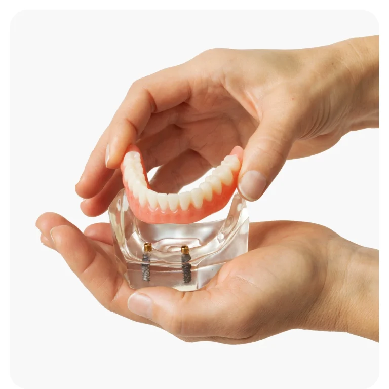Dentures Types of Dentures Implant Dentures Product Feature Media Slider Image 3 AD