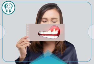 درمان خانگی درد لثه