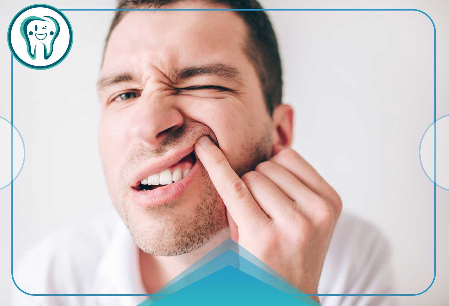 درمان خانگی درد لثه؛ دلایل، علائم و موثرترین روشهای تسکین سریع 3 علتهای اصلی التهاب و عفونت لثه