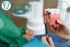 عصب کشی مجدد دندان