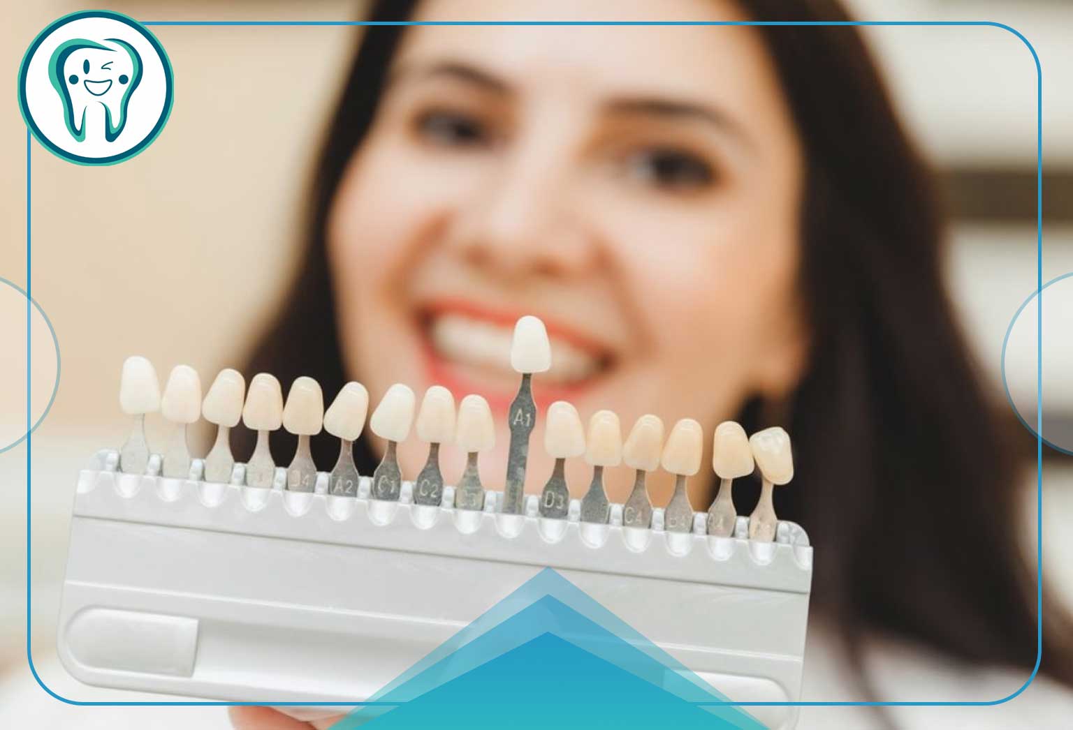 لمینت دندان برای دیابتی ها؛ ایمنی، مزایا و مراقبتهای حیاتی 2 مراحل انجام لمینت دندان برای دیابتی ها