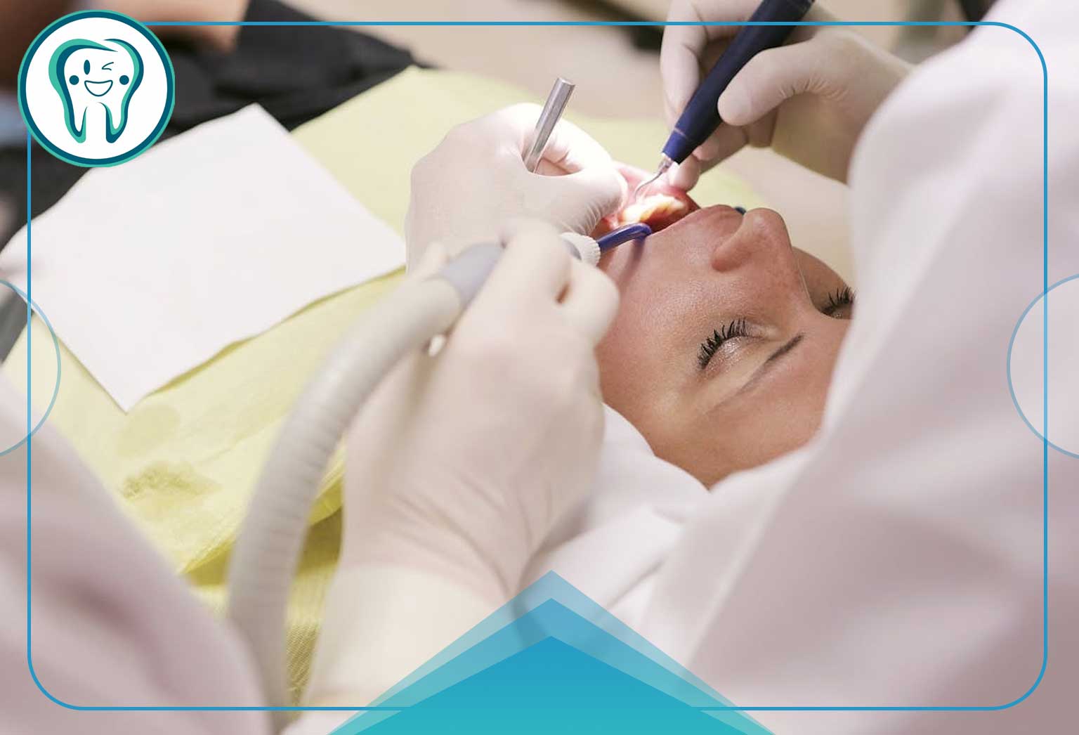 مراحل انجام ترمیم دندان جلو