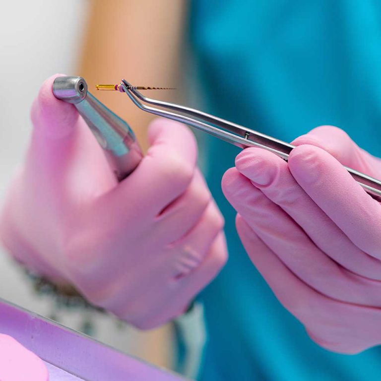 denwest dental clinic family root canal
