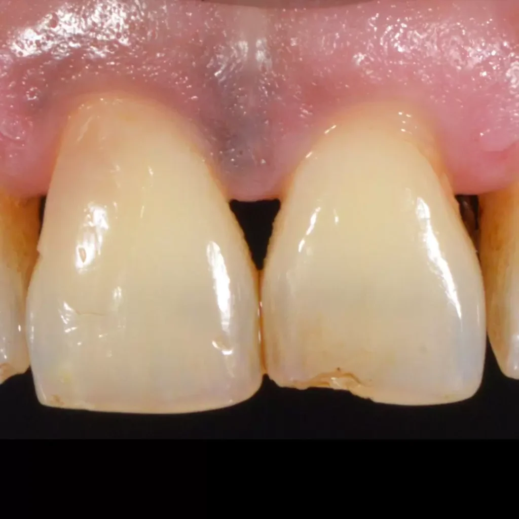 wedwedwed 1080x1080 1