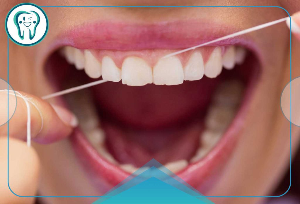 دلیل خونریزی لثه هنگام نخ دندان؛ حقیقتی که بسیاری نادیده میگیرند! 1 خونریزی لثه هنگام نخ دندان