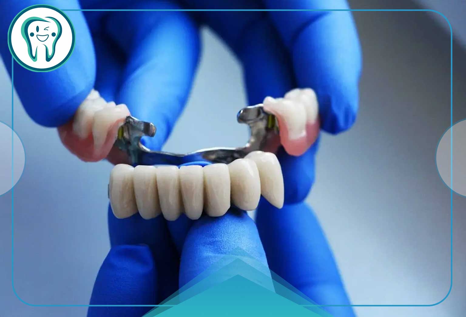 انواع پل دندانپزشکی و کاربرد هرکدام در درمان بیدندانی 2 کاربردهای پل دندانپزشکی