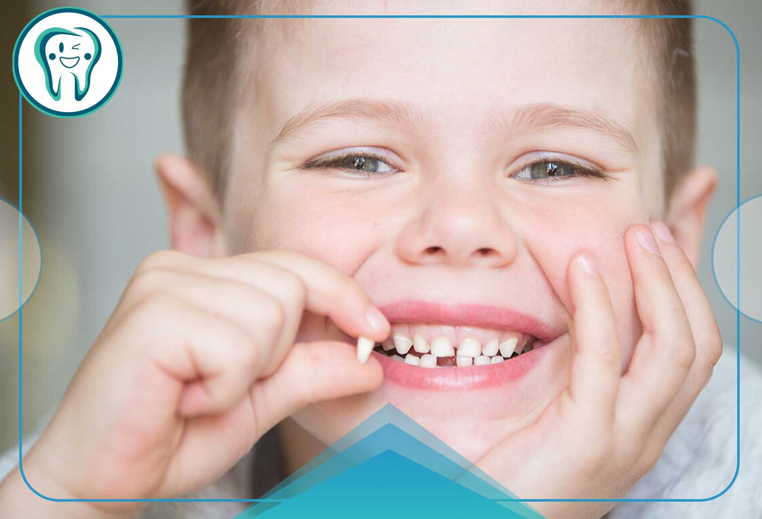 عصب کشی دندان شیری: آیا دندان شیری عصب کشی میشود؟ 3 حفظ دندان شیری