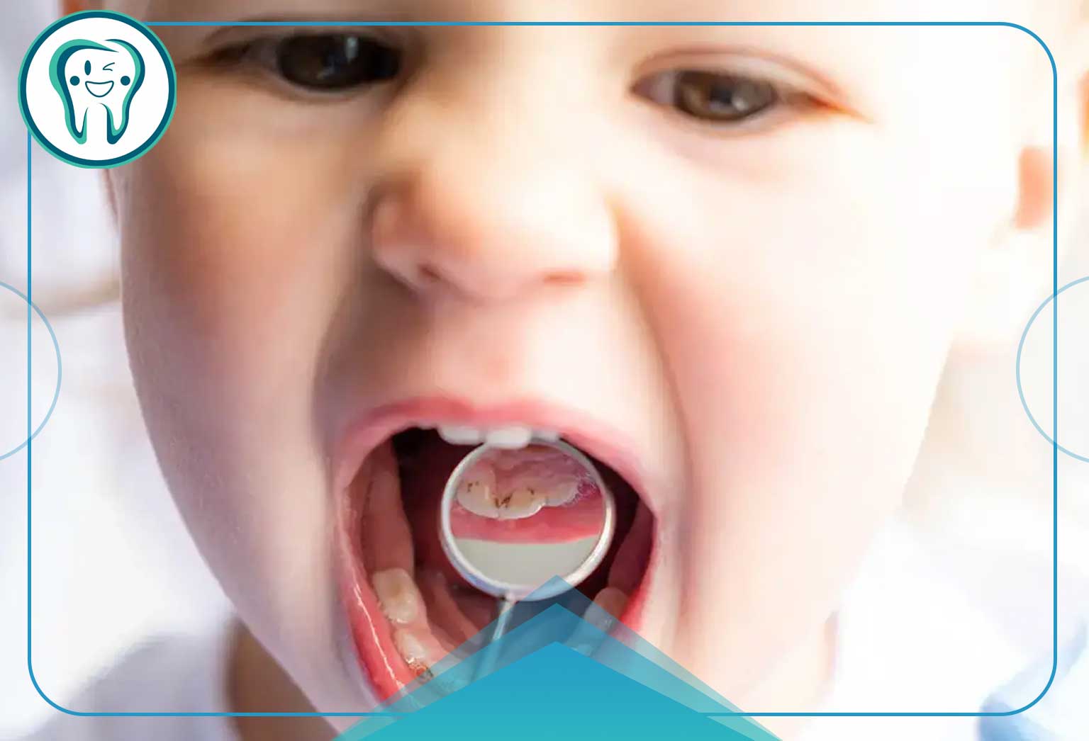 تأثیر قطره آهن برای کودکان : راهنمایی جامع و کامل برای والدین نگران 6 جدول مقایسه روشهای پیشگیری و درمان تاثیر قطره آهن بر دندان کودکان