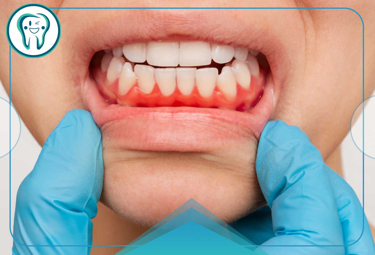 چگونه بفهمیم درد لثه ما ریشه عصبی دارد؟ (علائم افتراقی)