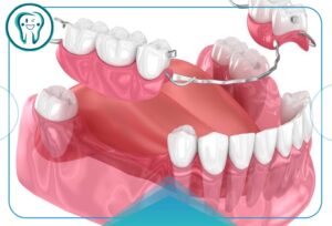 وبلاگ 35 things you should know about flipper teeth
