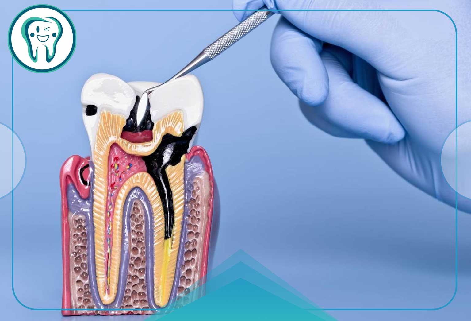 چرا قبل از ترمیم به کف بندی دندان نیاز داریم؟ 1 Dental pulp