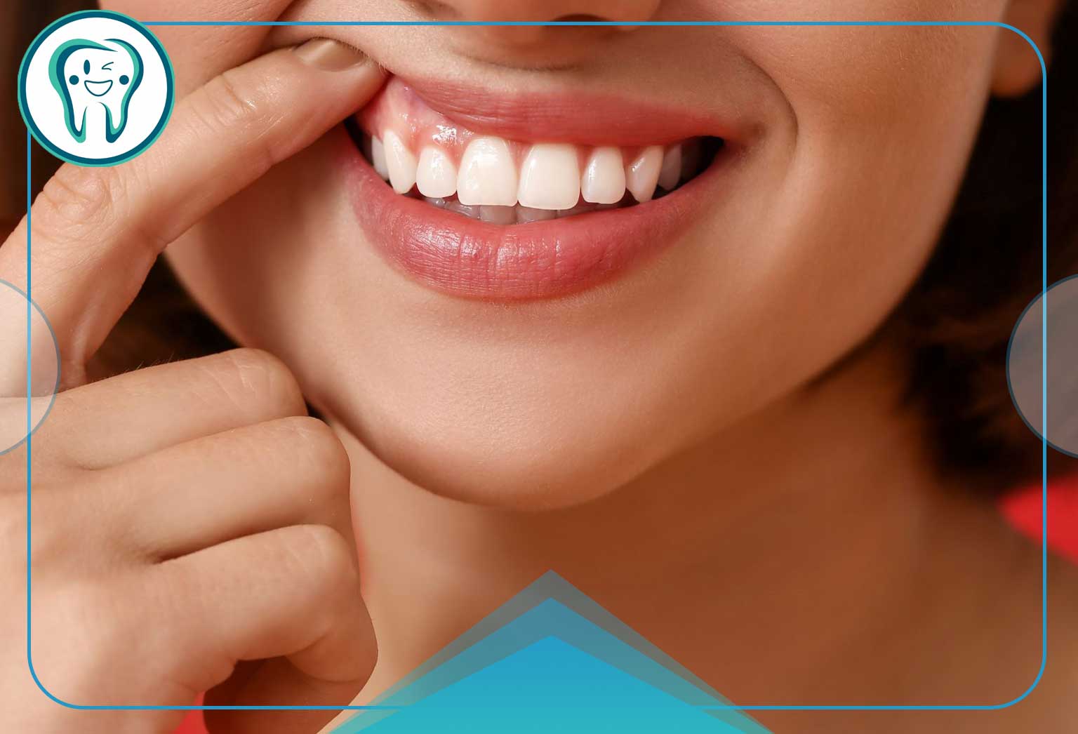پروتز دندان برای لثه تحلیل‌رفته