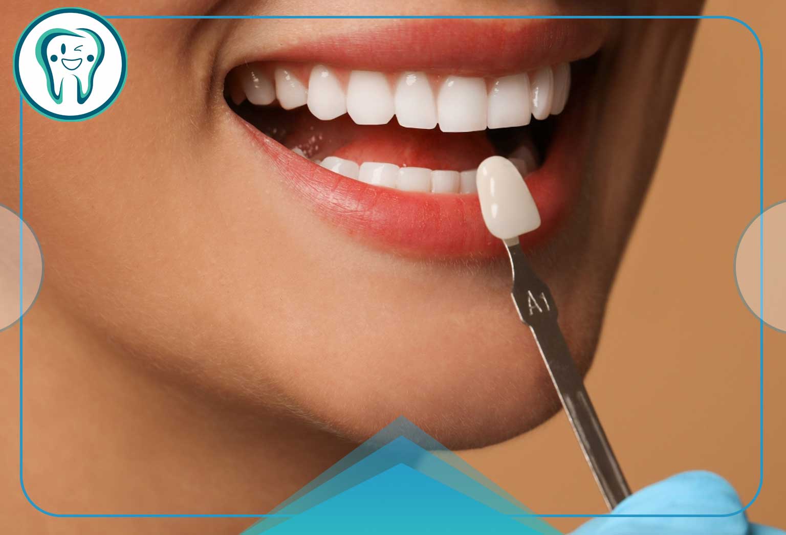 روکش دندان بعد از عصب کشی؛ هر آنچه باید قبل از تصمیمگیری بدانید 4 تفاوت انتخابهای درمانی روکش دندان