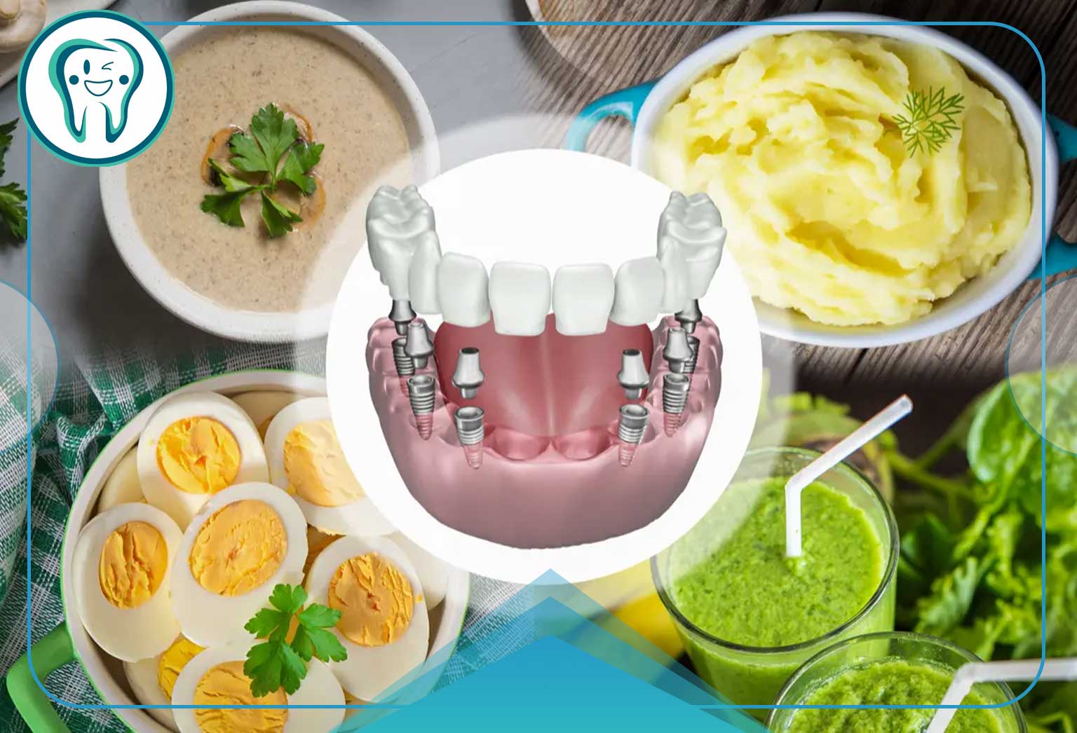 تغذیه بعد از نصب اوردنچر