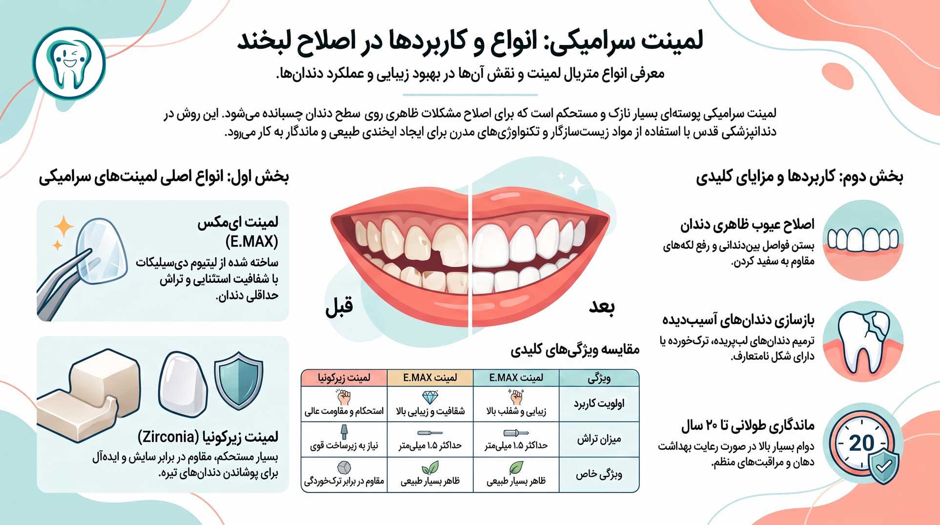 مزایای لمینت سرامیکی
