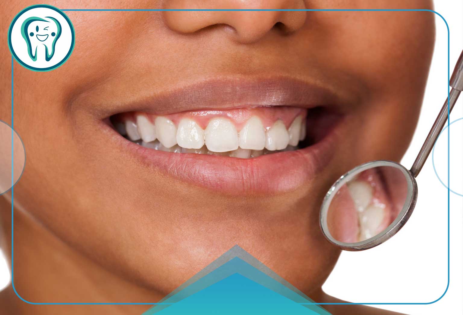 جراحی افزایش طول تاج دندان 3 تاج دندان
