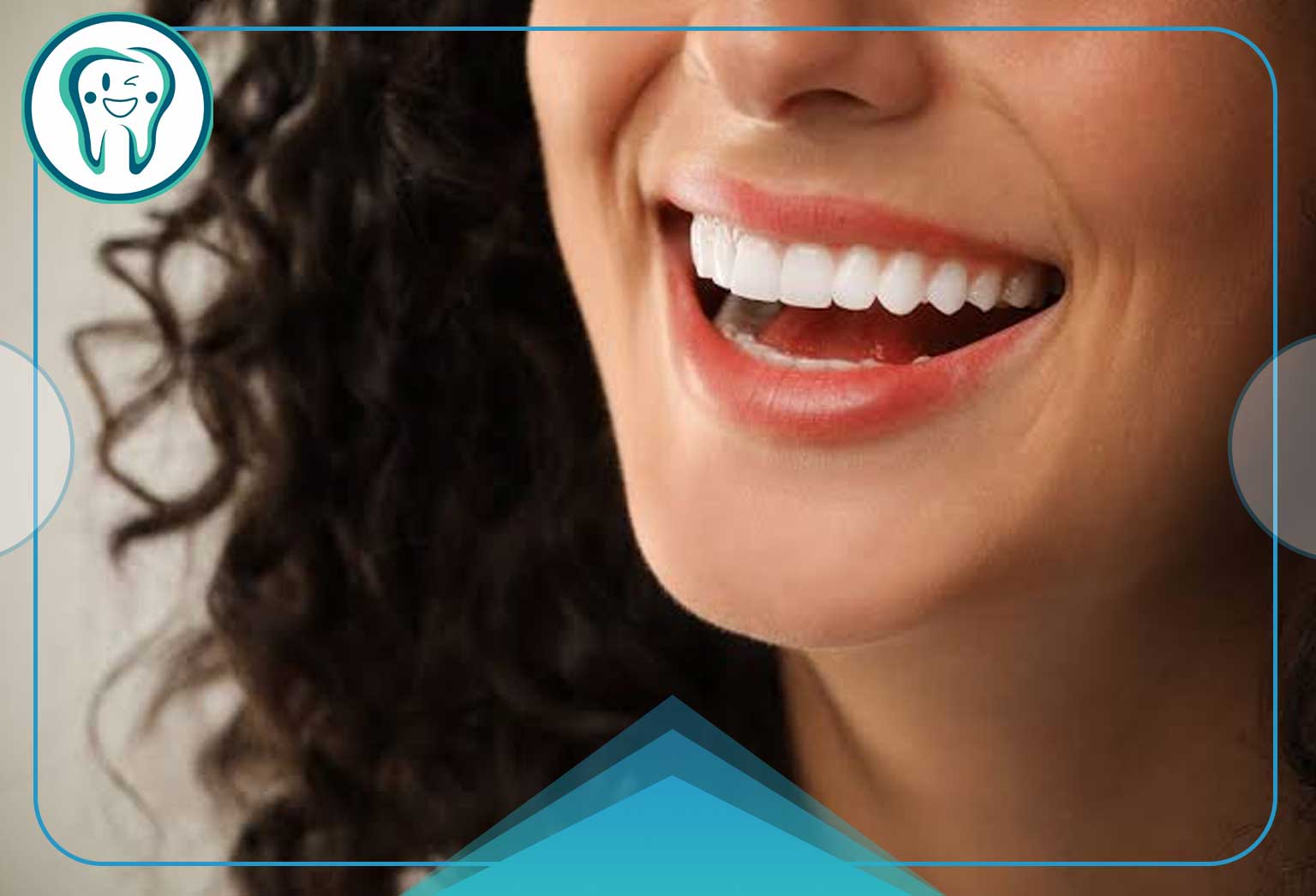 اصلاح طرح لبخند 2 تغییر شکل لبخند
