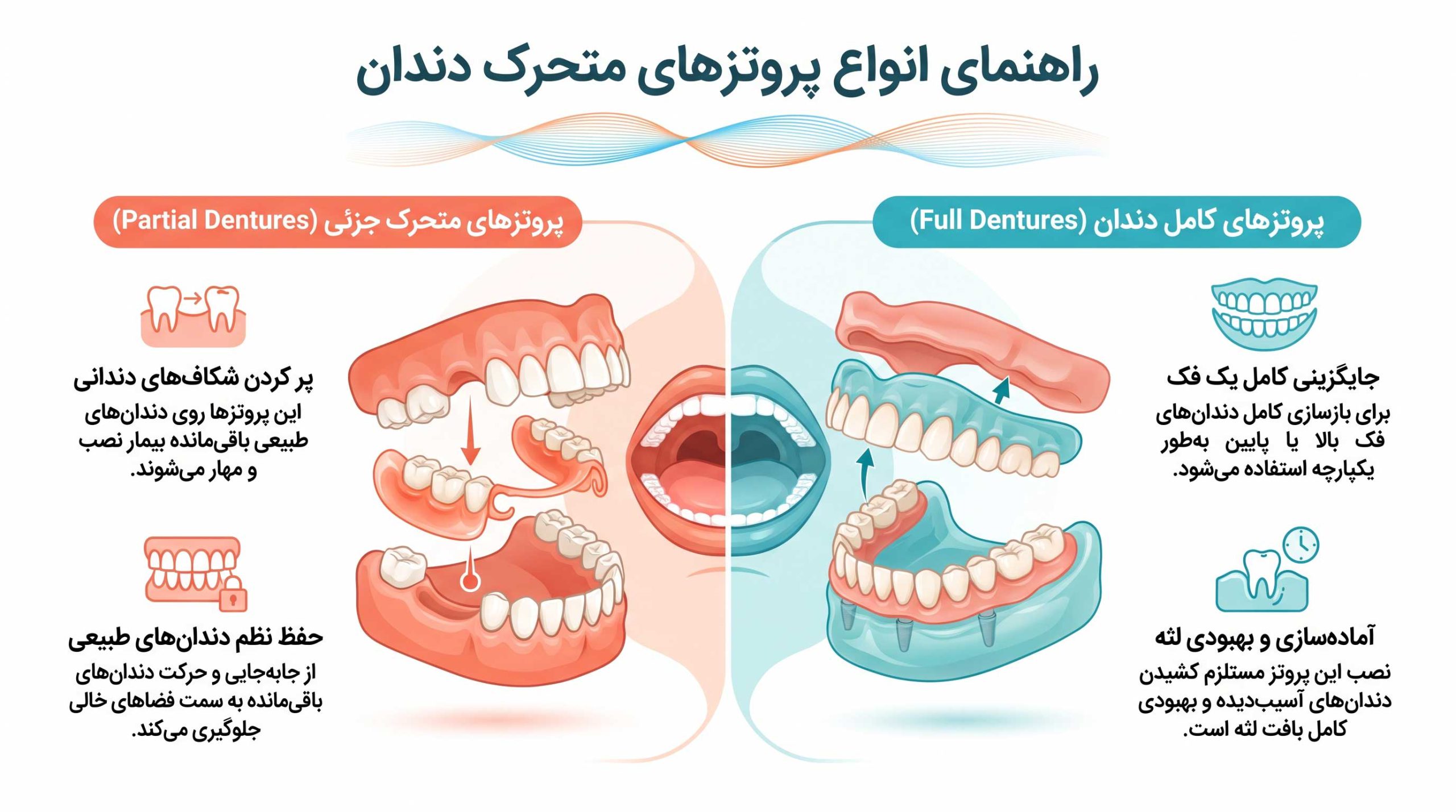 پروتز متحرک دندان 1 رایجترین انواع پروتزهای متحرک دندان