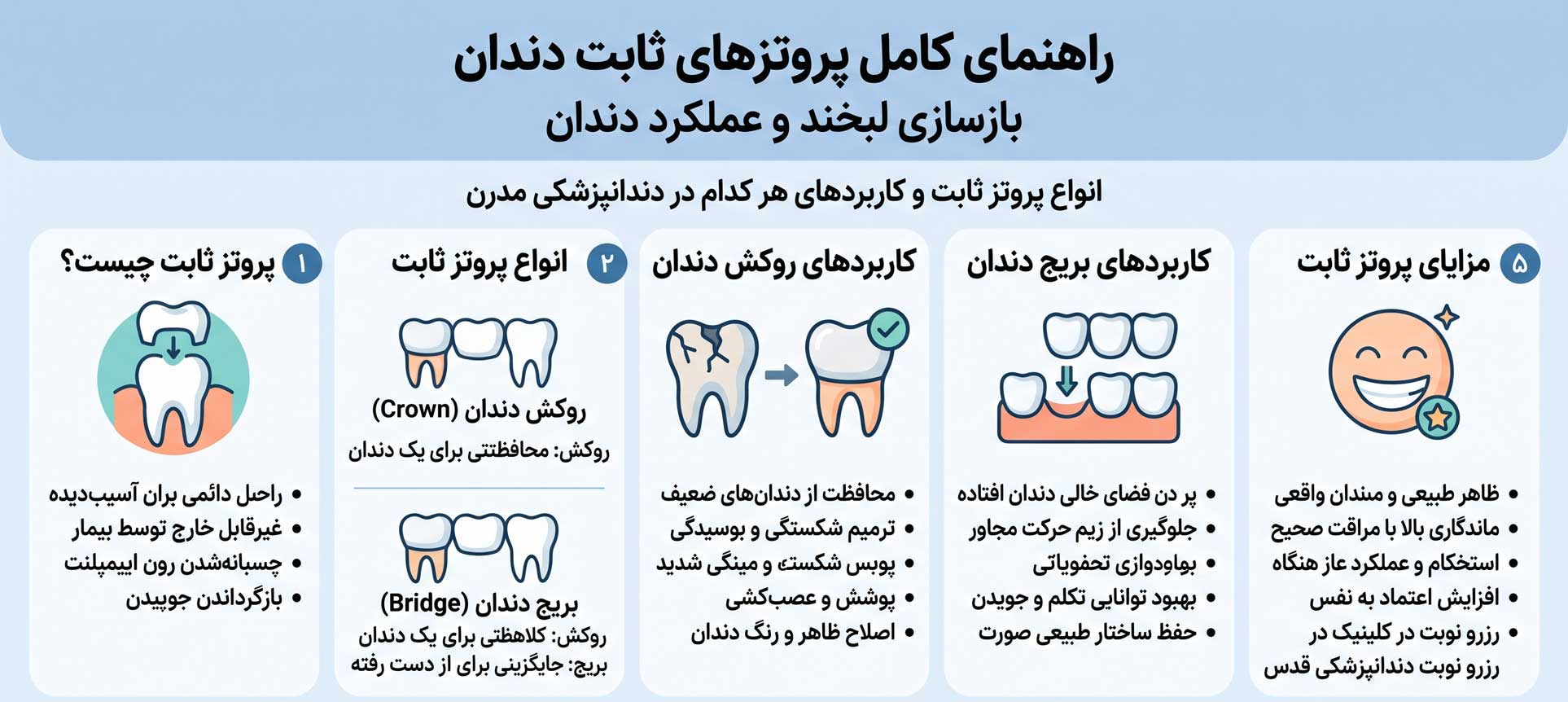 پروتز های ثابت 1 انواع پروتز ثابت دندان