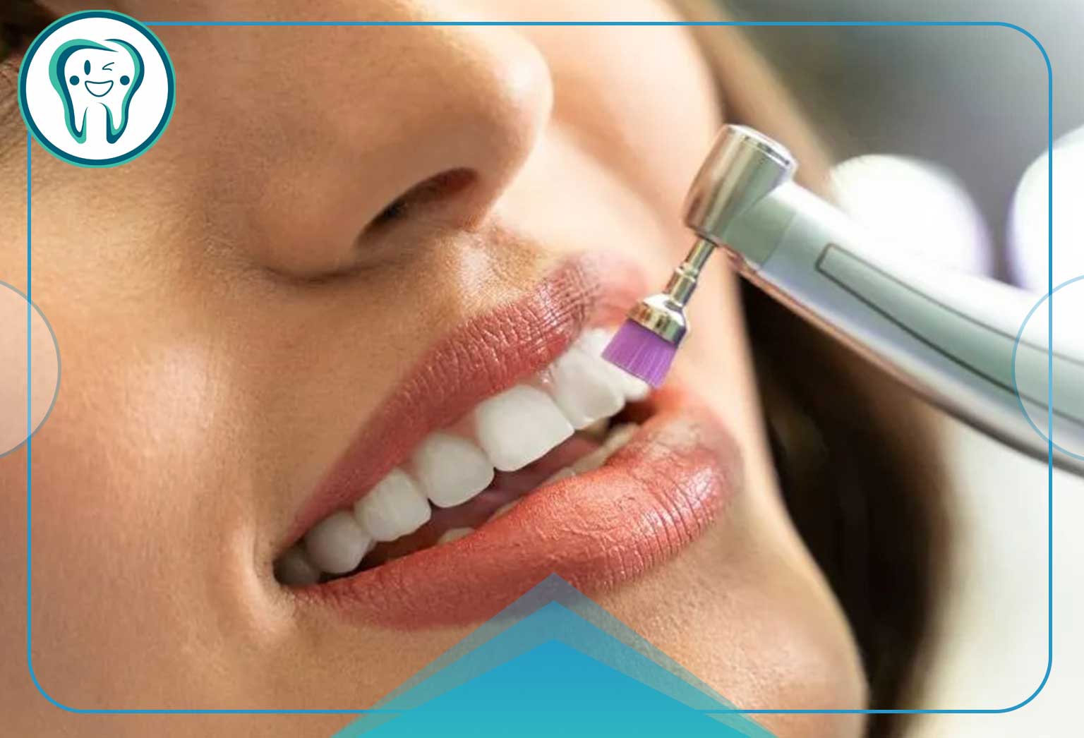 teeth scaling and polishing